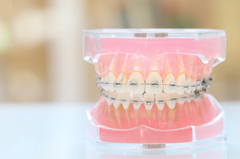 大人だからこそ始めたい。心と体の健康を守る成人矯正